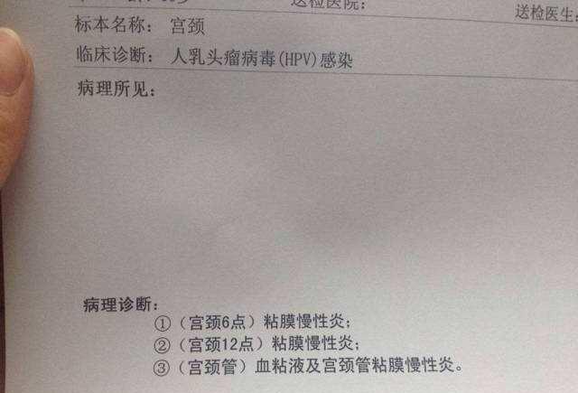宮頸有問(wèn)題的前兆，了解并預(yù)防宮頸健康風(fēng)險(xiǎn)，宮頸健康風(fēng)險(xiǎn)預(yù)警，預(yù)防宮頸問(wèn)題，了解前兆與措施