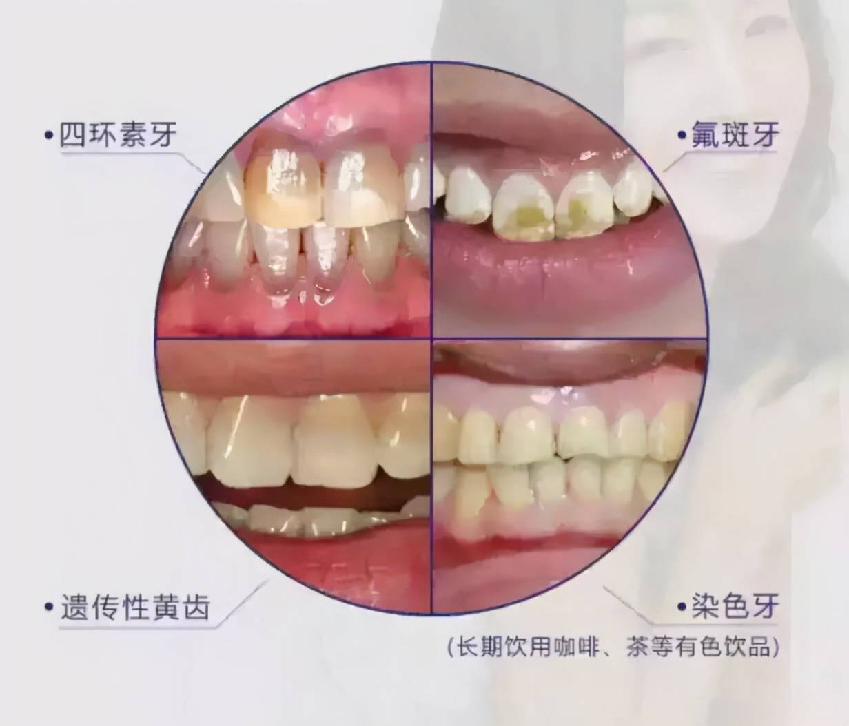 牙齒太黃了有什么辦法弄白嗎？全面解析牙齒美白的方法與技巧，全面解析牙齒美白方法與技巧，牙齒黃變白的實(shí)用建議與技巧
