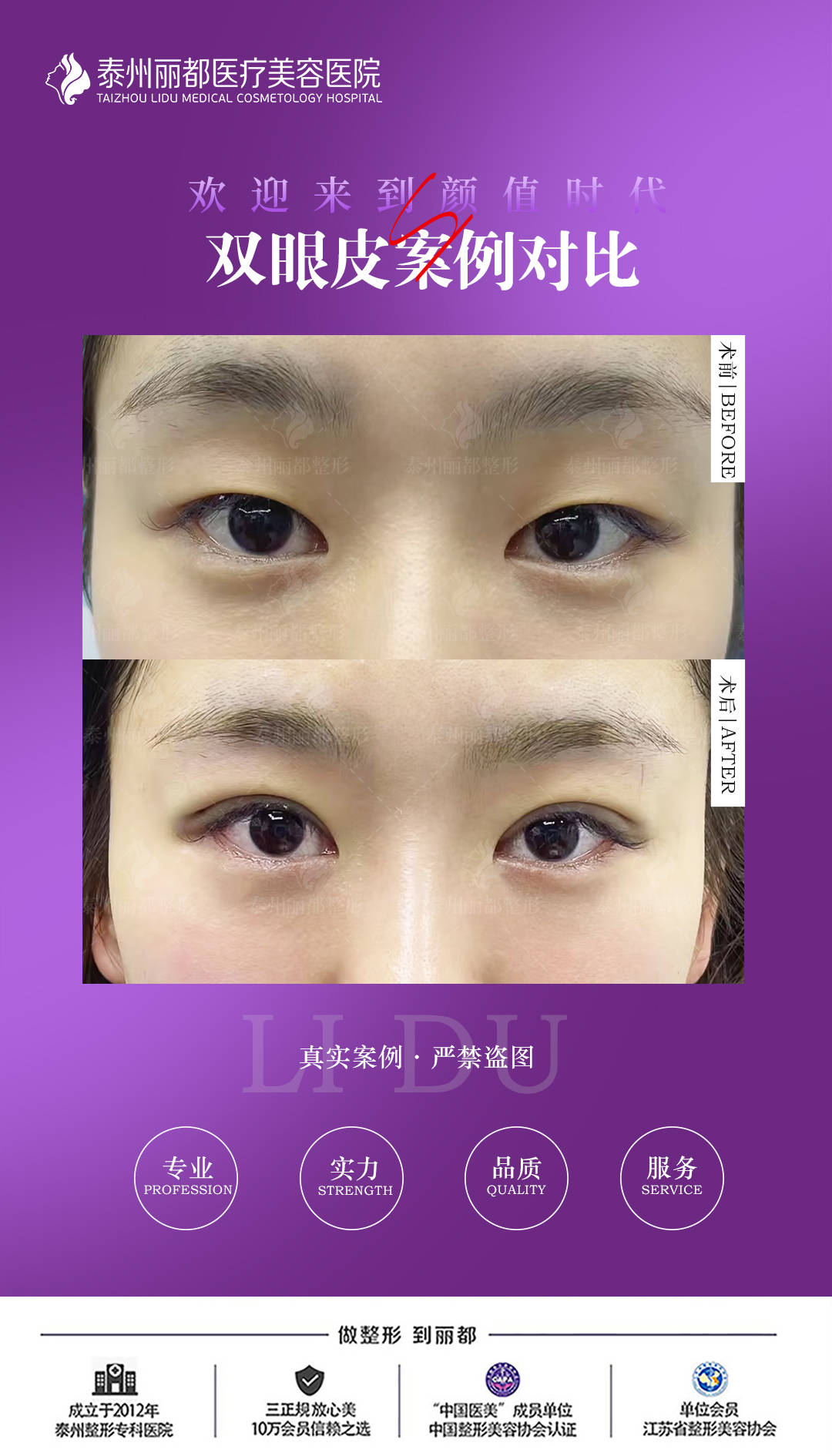 尋找附近割雙眼皮的最佳醫(yī)院，專業(yè)、信譽(yù)與品質(zhì)并重，尋找附近專業(yè)信譽(yù)與品質(zhì)并重的割雙眼皮最佳醫(yī)院