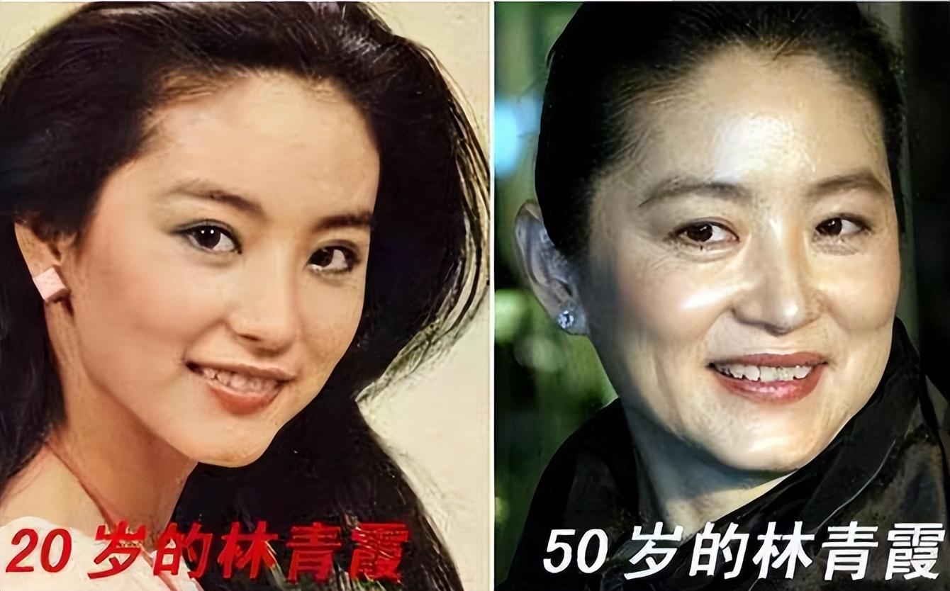 整容的明星女對(duì)比，美麗背后的故事，整容明星女對(duì)比，美麗背后的故事揭秘