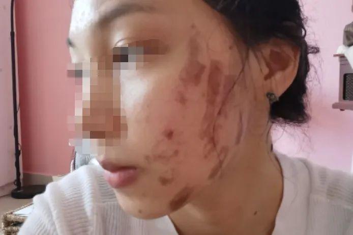 光子嫩膚與衰老，真相揭秘，你老得快嗎？，揭秘光子嫩膚與衰老真相，你了解衰老背后的秘密嗎？